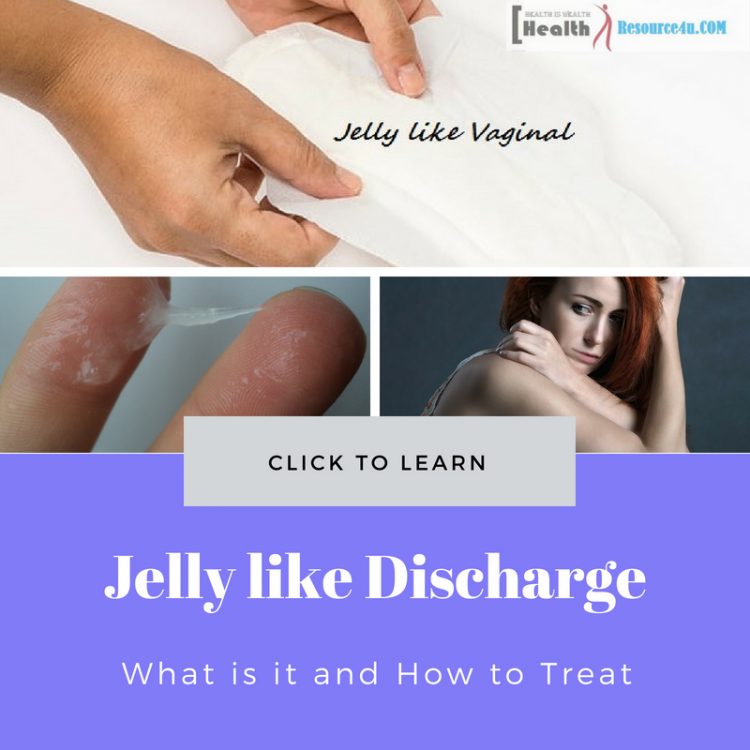 Jelly like Vaginal Discharge