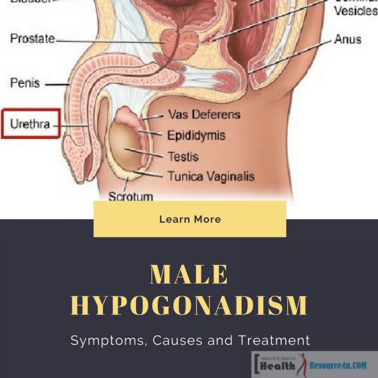 Male Hypogonadism e1525847773624