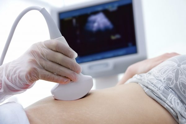 Ultrasound Pregnancy