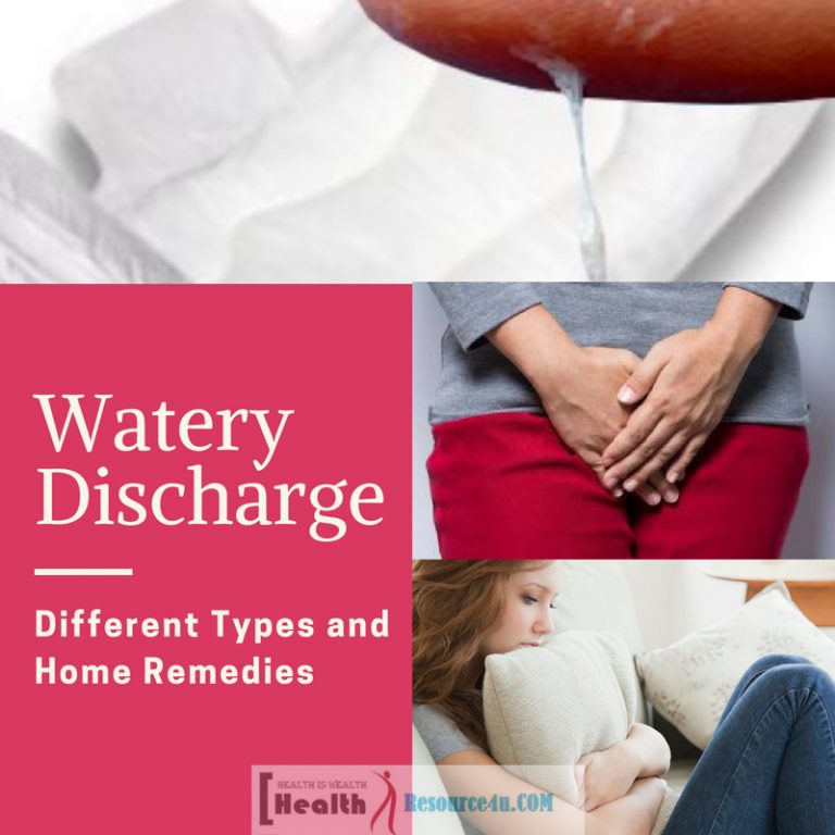 Watery Discharge