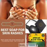 Best Soap for Skin Rashes