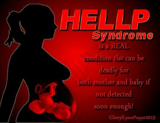 HELLP Syndrome