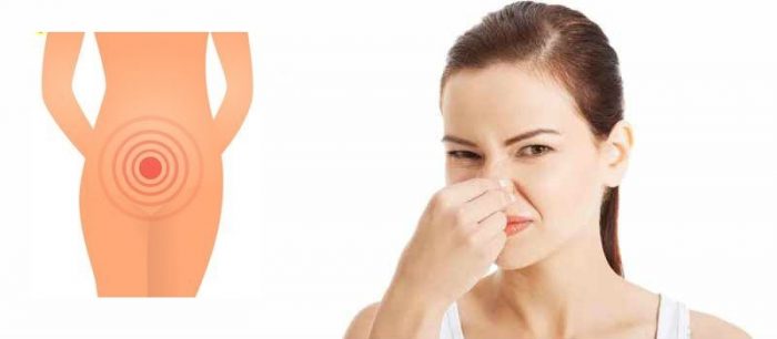 Remedies for Fishy Vaginal Odor