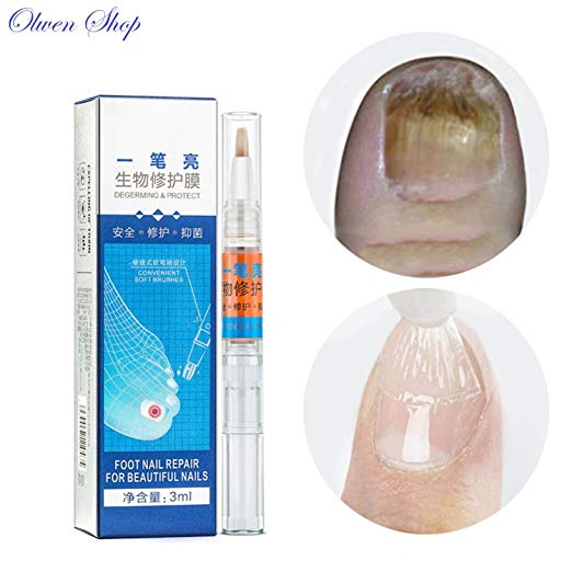 Olwen Shop 1PCS Fungal Nail Treatment
