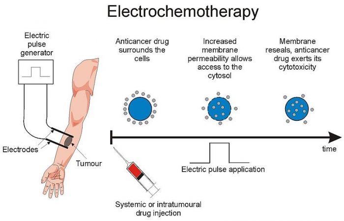 Common Chemotherapy Side Effects