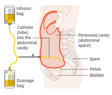 Chemotherapy