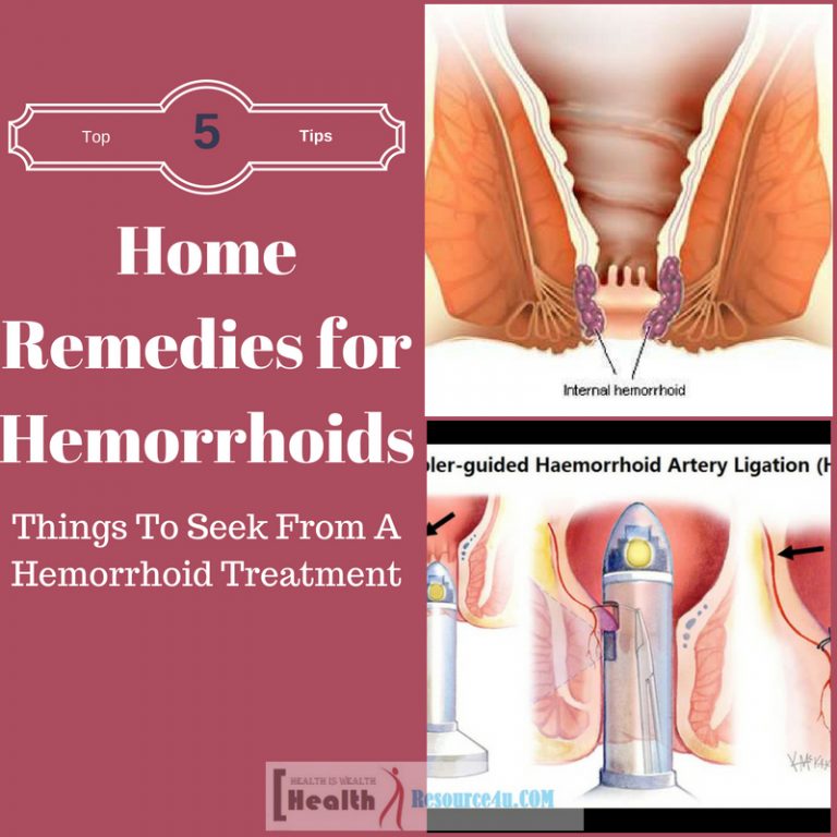 Home Remedies for Hemorrhoids