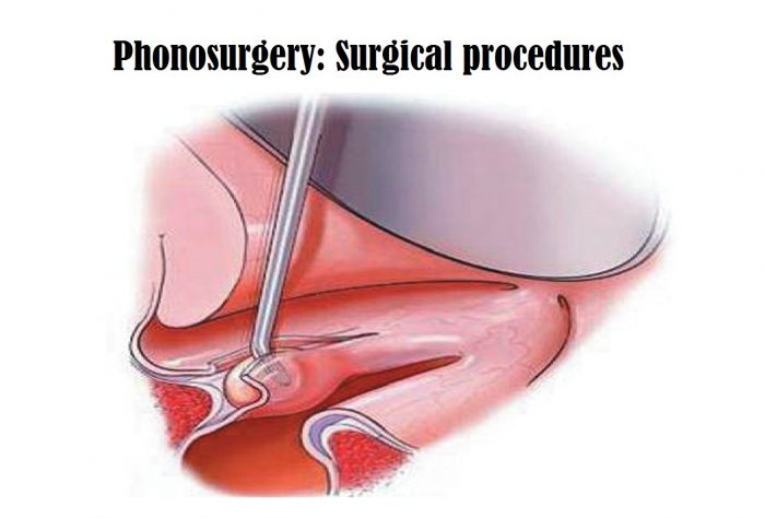 Phonosurgery: Surgical procedures