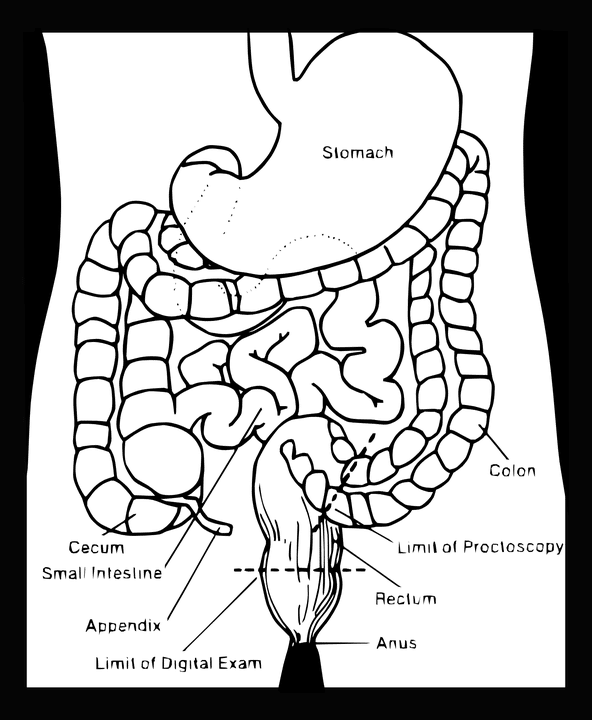 Prolapsed Internal Hemorrhoids Treatment