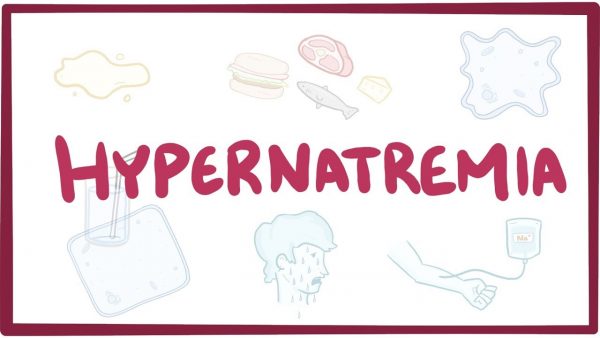 symptoms of hypernatremia