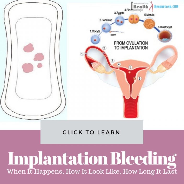 Implantation Bleeding