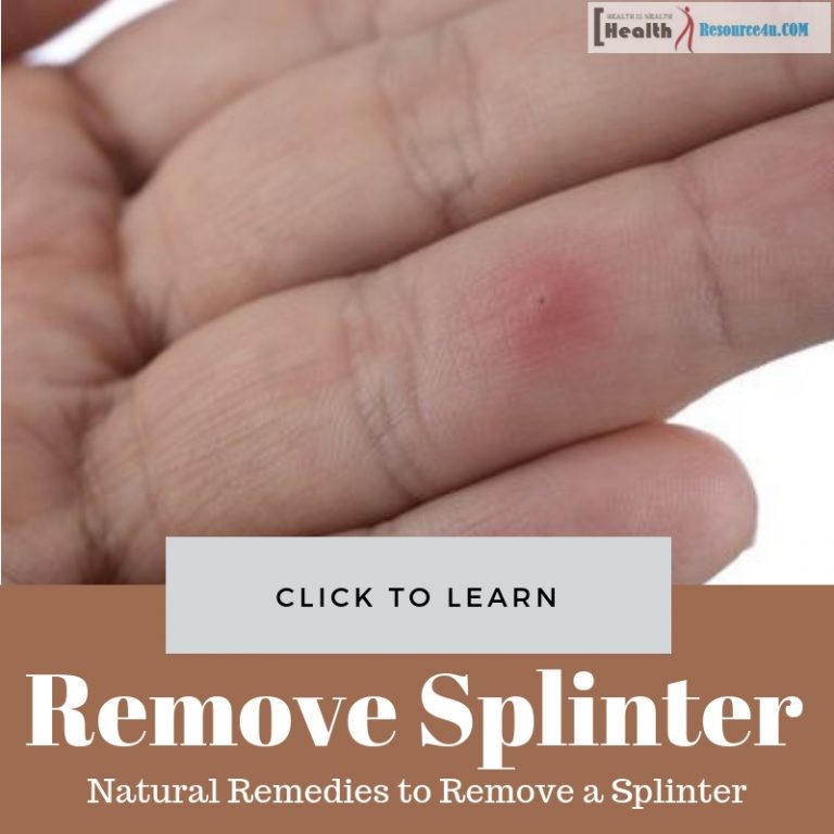 Natural Remedies to Remove a Splinter