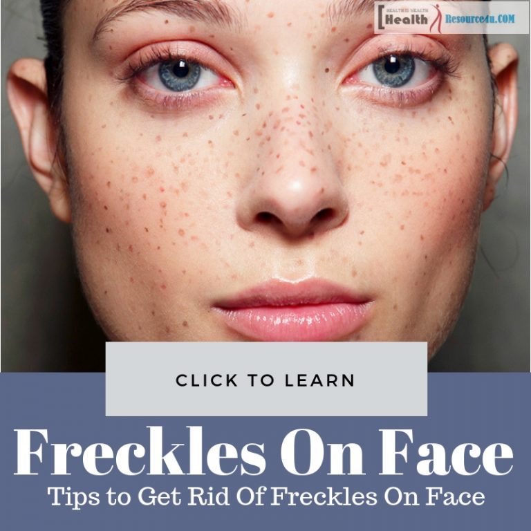Get Rid Of Freckles On Face