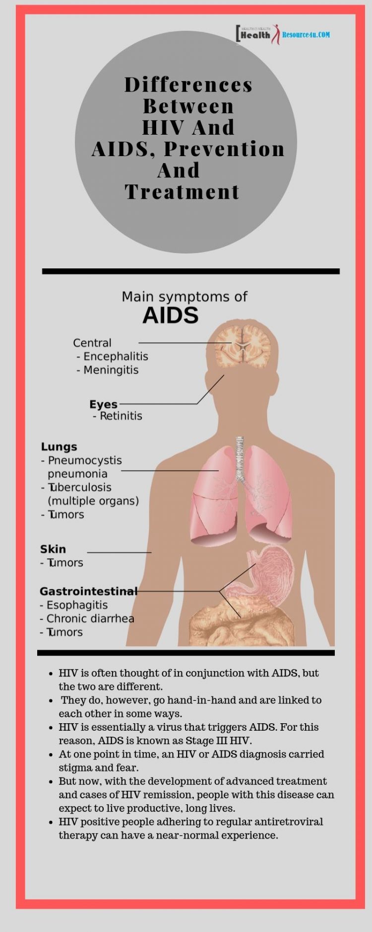 HIV And AIDS Infographic