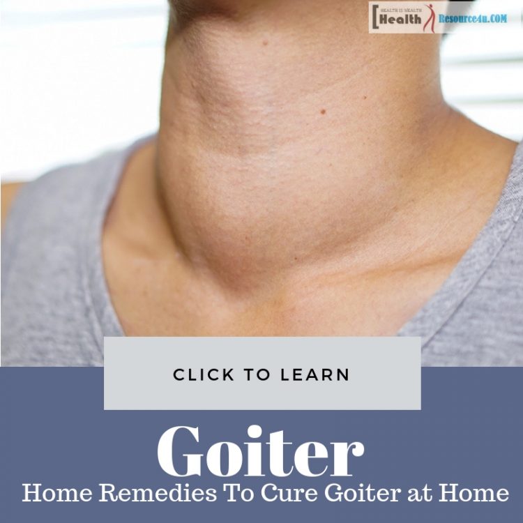 Home Remedies To Cure Goiter