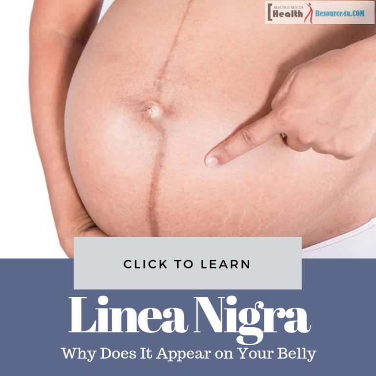 Linea Nigra