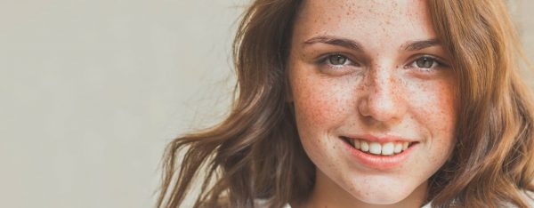 tips to get rid of freckles on face