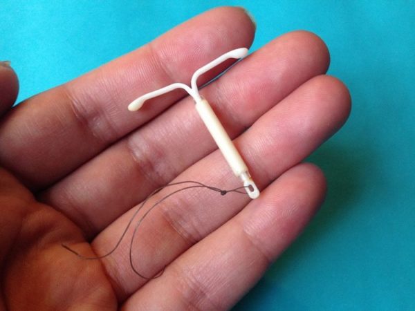 benefits of IUD birth control