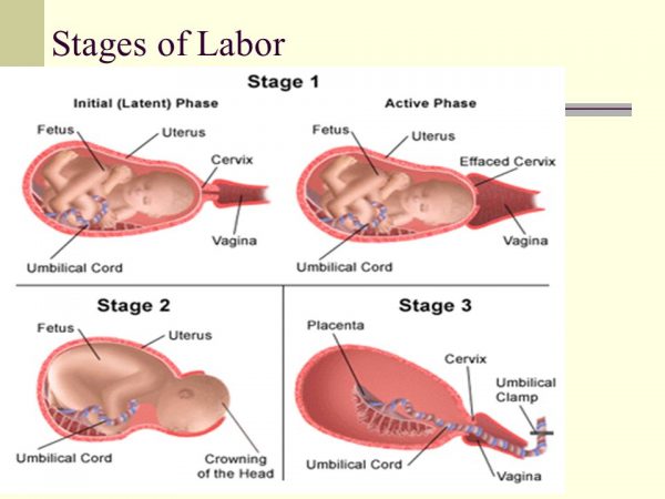 stages of labor