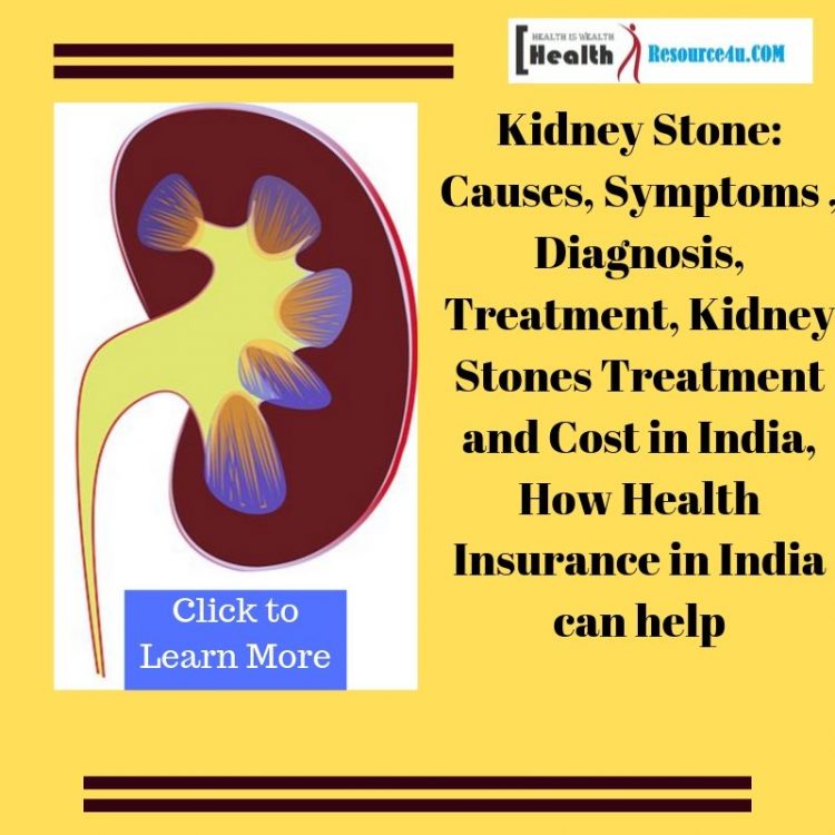 Kidney Stones