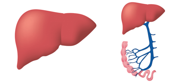 Types of Ascites