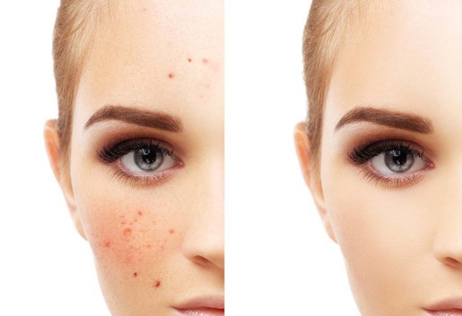 home treatment to cure red spots on skin