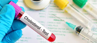 cholesterol test