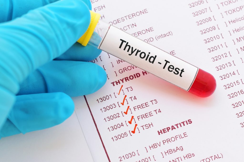 thyroid test