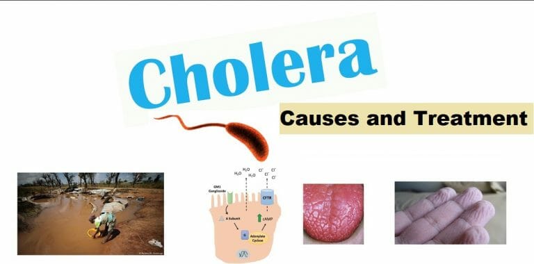 Cholera : Causes, Symptoms, Treatment And Prevention