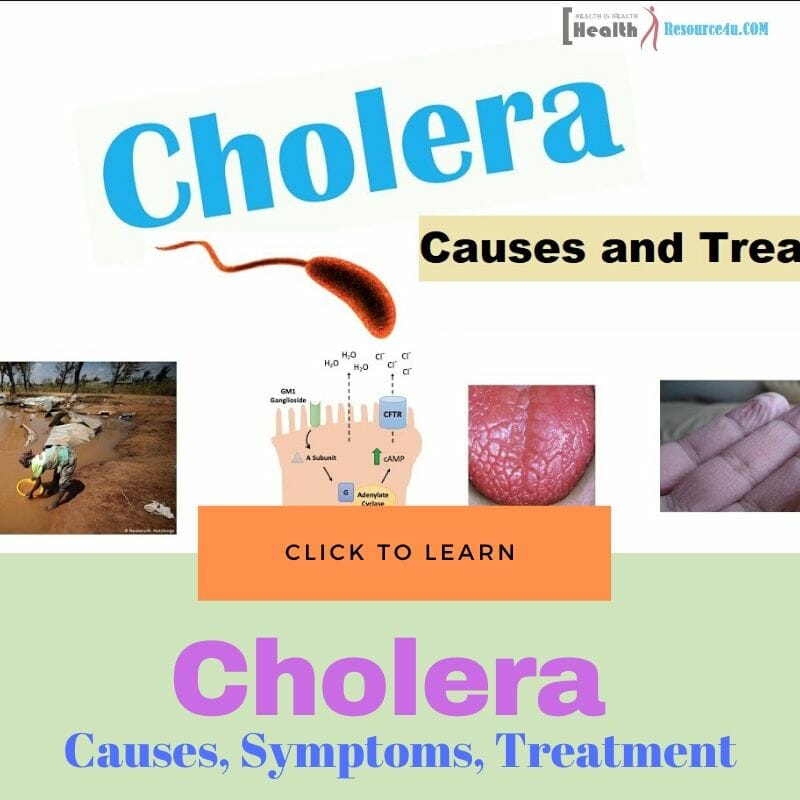 Cholera Causes Treatment