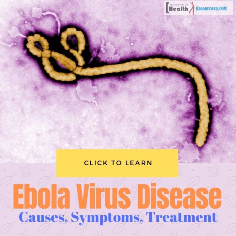 Ebola Virus Disease