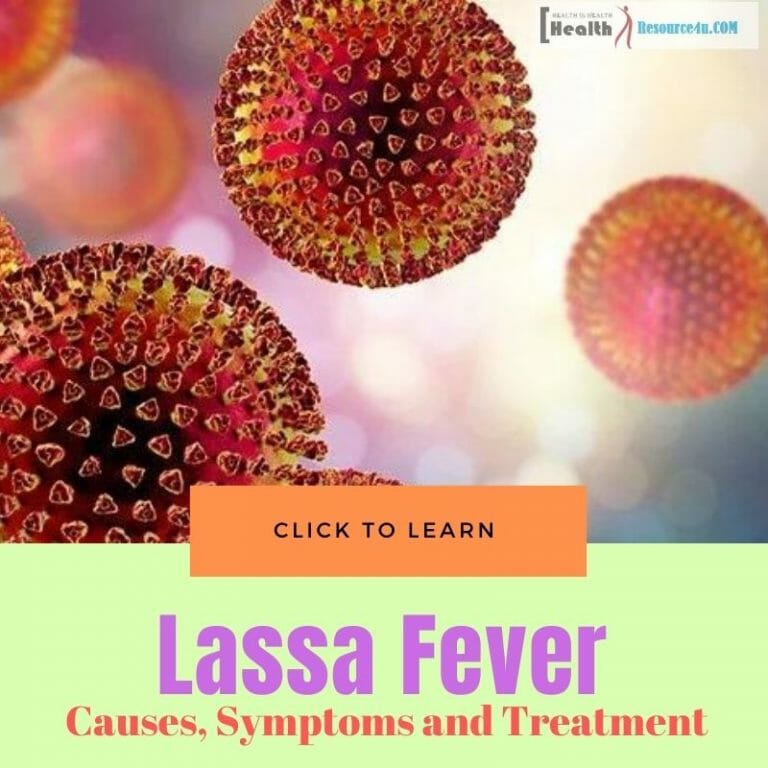 Lassa fever outbreaks