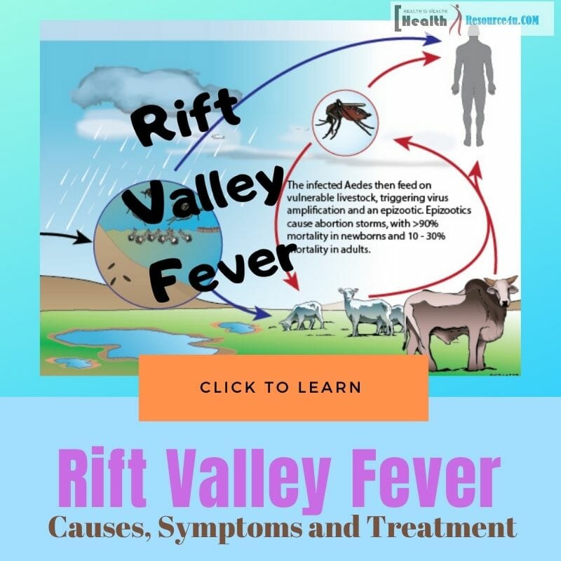 Rift Valley Fever Causes treatment