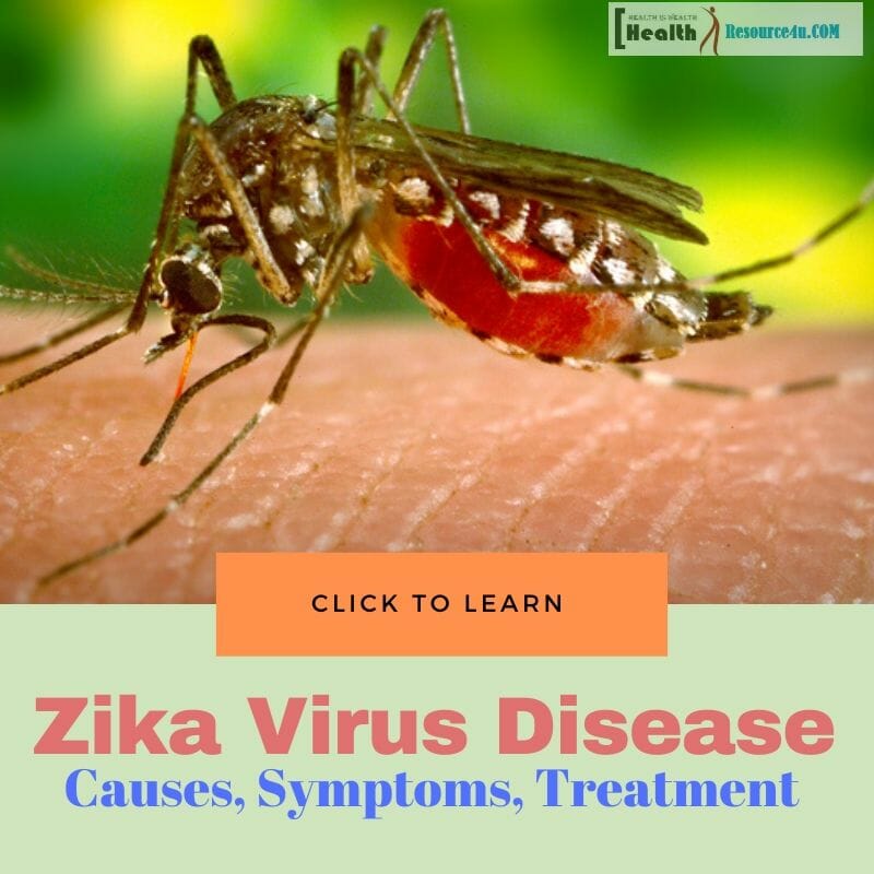 Zika Virus Disease