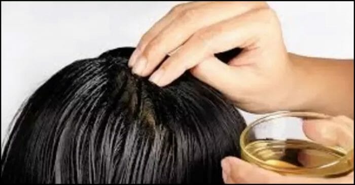 Castor oil helps to treat baldness