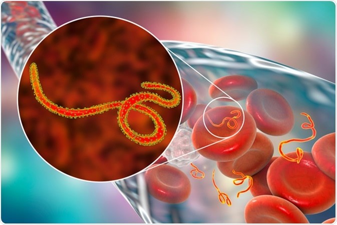 symptoms of Ebola virus disease