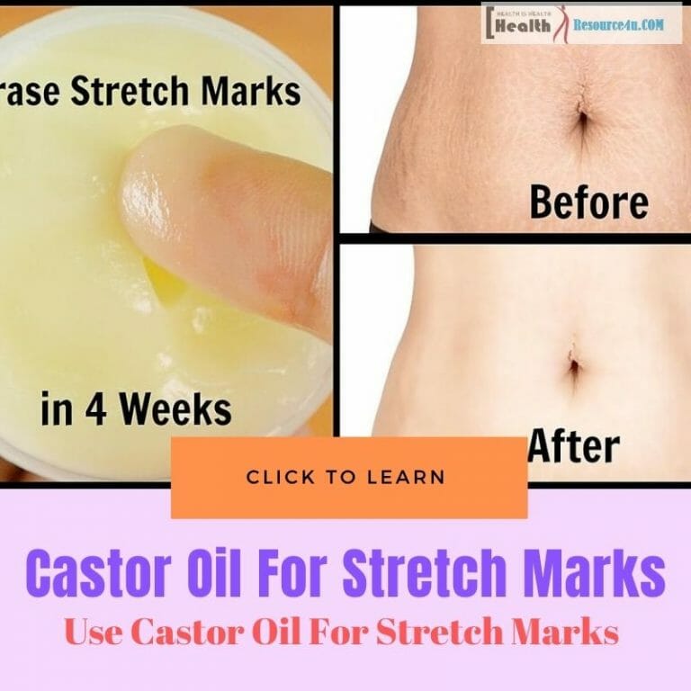Use Castor Oil For Treating Stretch Marks