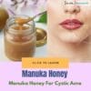 Manuka Honey for Relief in Cystic Acne
