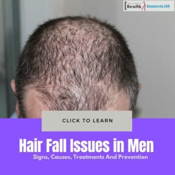 Hair Fall Issues in Men