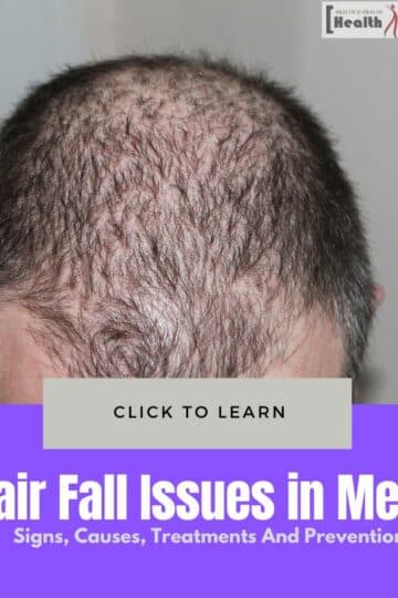 Hair Fall Issues in Men